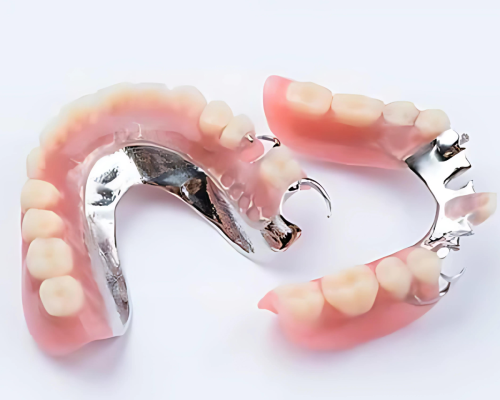 cast-partial-denture